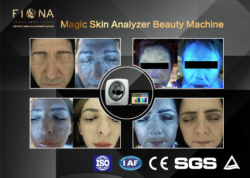 Uv Light Facial Skin Analyser Machine Multi Function 50HZ For Age Test