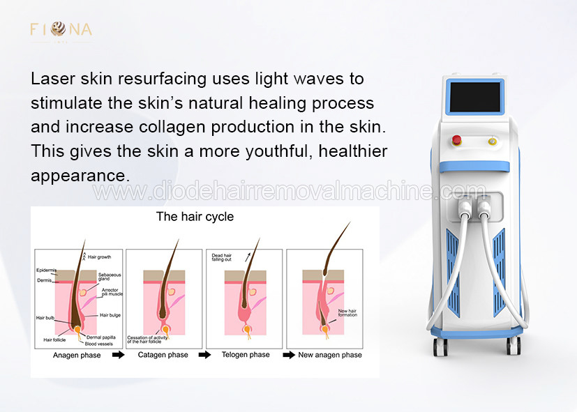 500 Thousand Shots Opt Shr Hair Removal Machine Multi Function Beauty Equipment