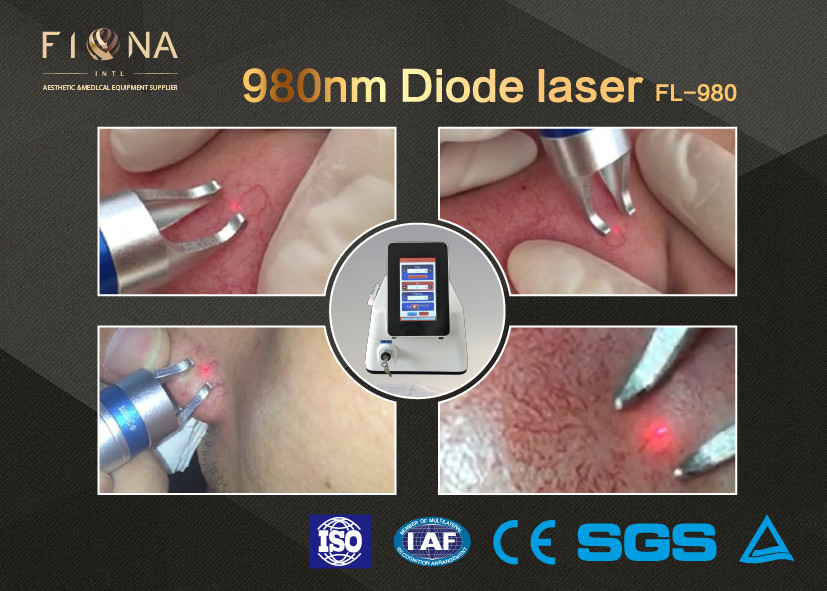 medsinglong Brand Diode laser 980 nm for spider vein removal / laser vascular removal machine