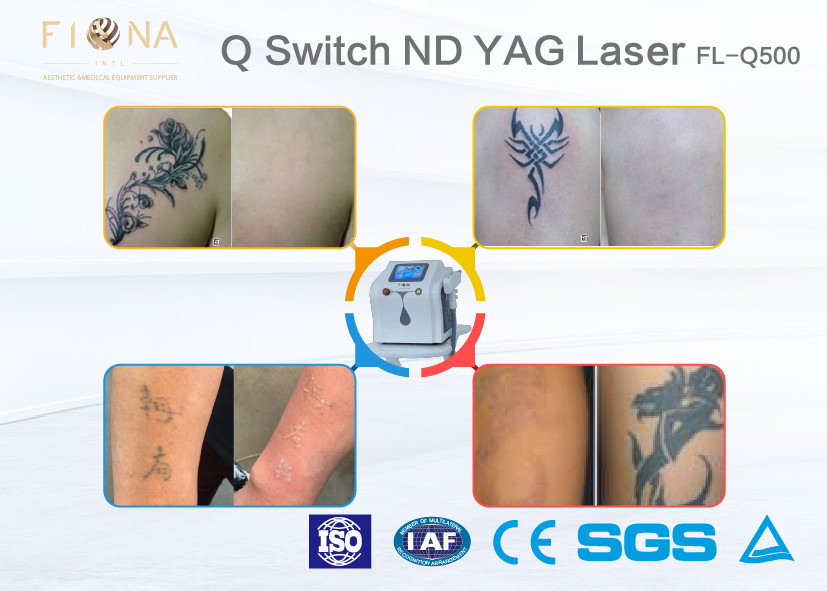 500W Power Q Switched ND YAG Laser Tattoo Machine Customized Color With Cooling System