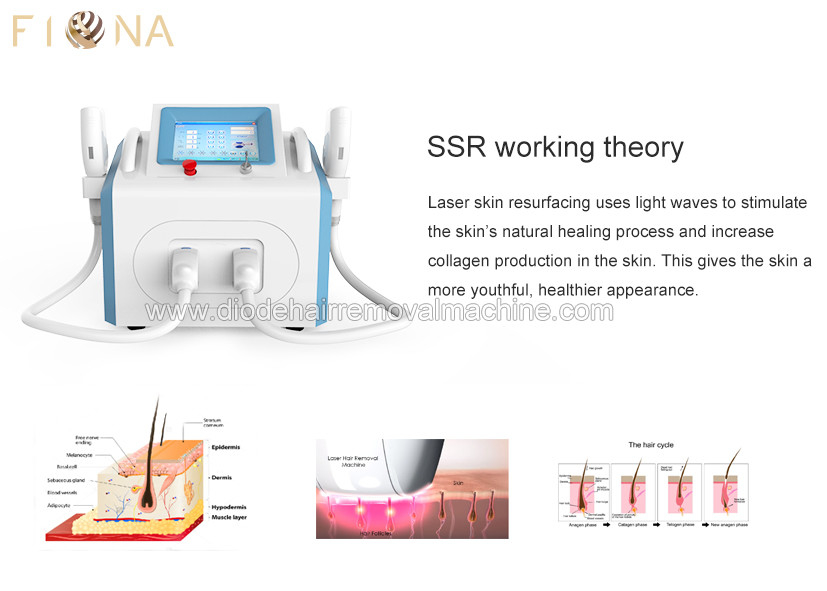 Beijing Fiona Intense pulse light laser type shr ssr opt adena ipl hair removal Acne removal
